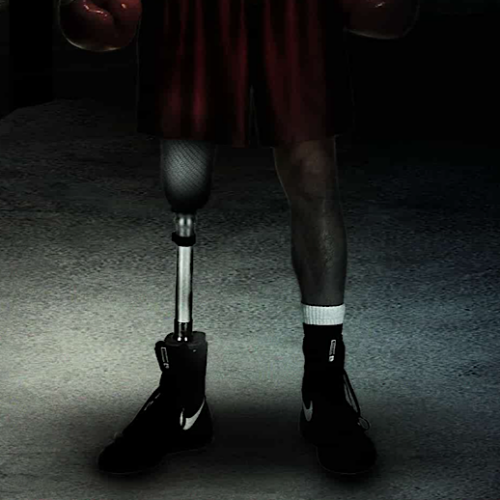 ‘Gensan Punch’: A Boxer with a Prosthetic Leg Strives for Greatness